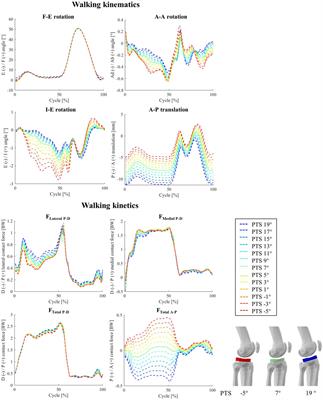 Posterior tibial slope influences joint mechanics and soft tissue loading after total knee arthroplasty